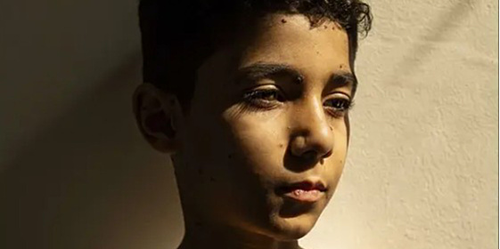 Izabrana najbolja novinska fotografija godine, prikazuje patnju i otpornost palestinskog dječaka