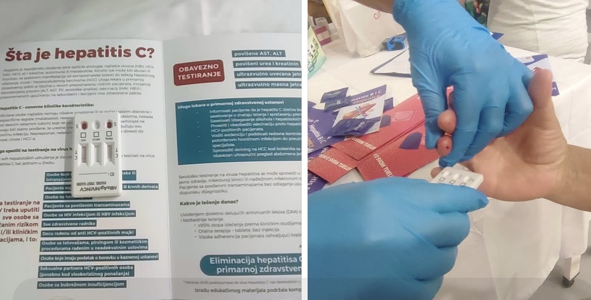 Besplatno testiranje na hepatitis B i C organizovano u Bihaću povodom Svjetskog dana hepatitisa