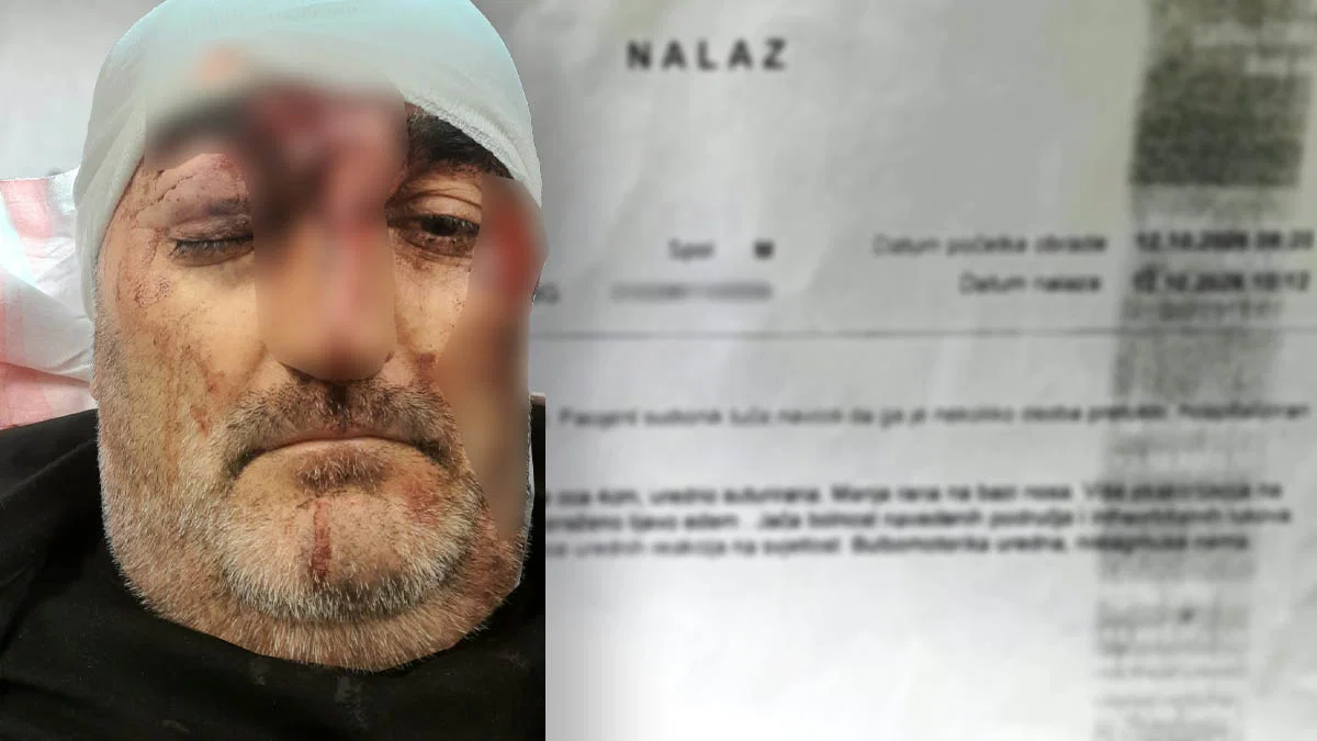 Marko Luburić navodi da je pretučen nakon lovačkog druženja na Kosmaju i završio u bolnici