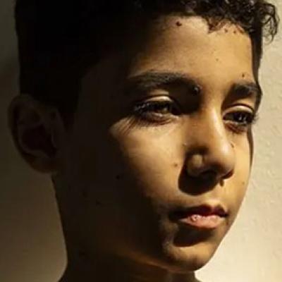 Izabrana najbolja novinska fotografija godine, prikazuje patnju i otpornost palestinskog dječaka Izabrana najbolja novinska fotografija godine, prikazuje patnju i otpornost palestinskog dječaka