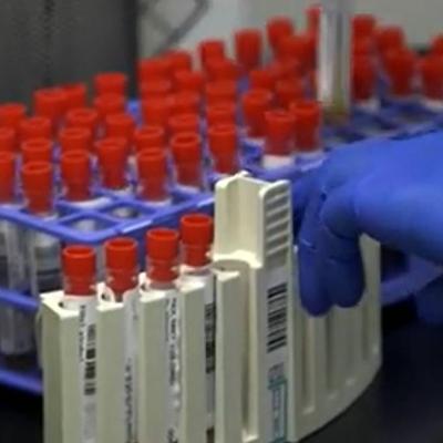 Nizozemska otkrila 85 donora sperme s više od 25 djece: "To je potpuni haos" Nizozemska otkrila 85 donora sperme s više od 25 djece: "To je potpuni haos"