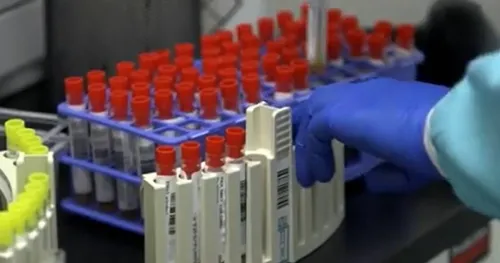 Nizozemska otkrila 85 donora sperme s vi&scaron;e od 25 djece: "To je potpuni haos"